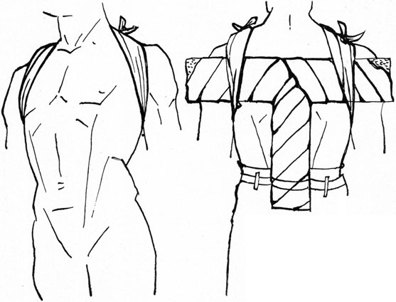 LEFT: FIGURE-OF-EIGHT BANDAGE FOR FRACTURE OF THE CLAVICLE
The forearm on the affected side is placed in a sling.
RIGHT: 'T' SPLINT FOR FRACTURE OF THE CLAVICLE
The forearm on the affected side is placed in a sling.