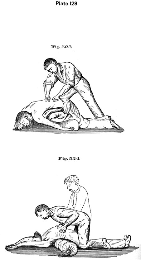 Plate 128, Fig 523-524. Performing chest compressions.