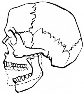 DIAGRAM SHOWING DISLOCATION OF THE MANDIBLE
