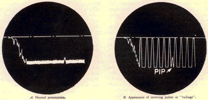 A. Normal presentation. B. Appearence of jamming pulses or 'railings'.