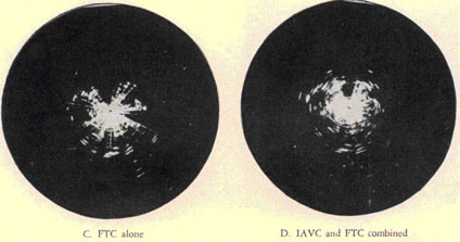 On left, C. FTC alone; On right D. IAVC and FTC combined.